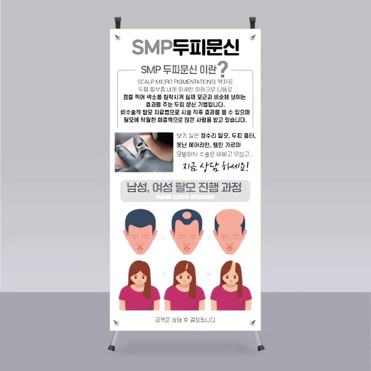 SMP 두피문신 미니배너