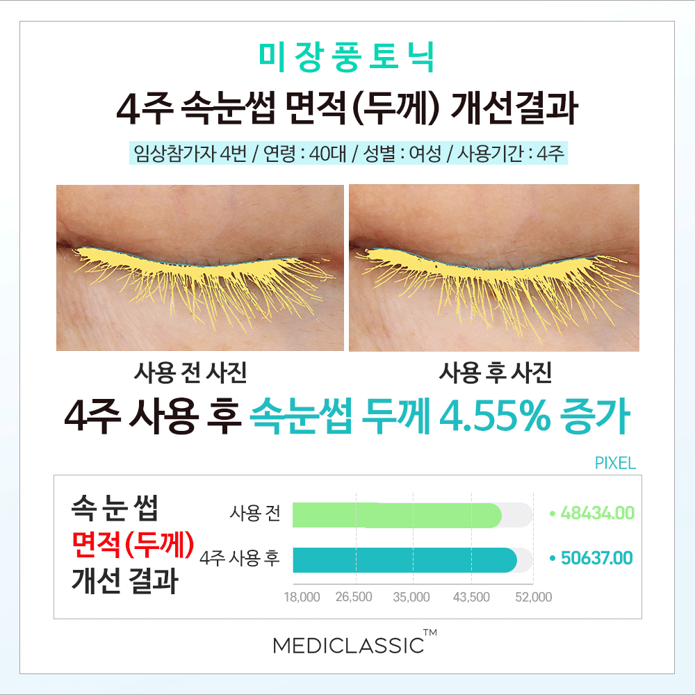 미장풍 골드 속눈썹 영양제 7ml
