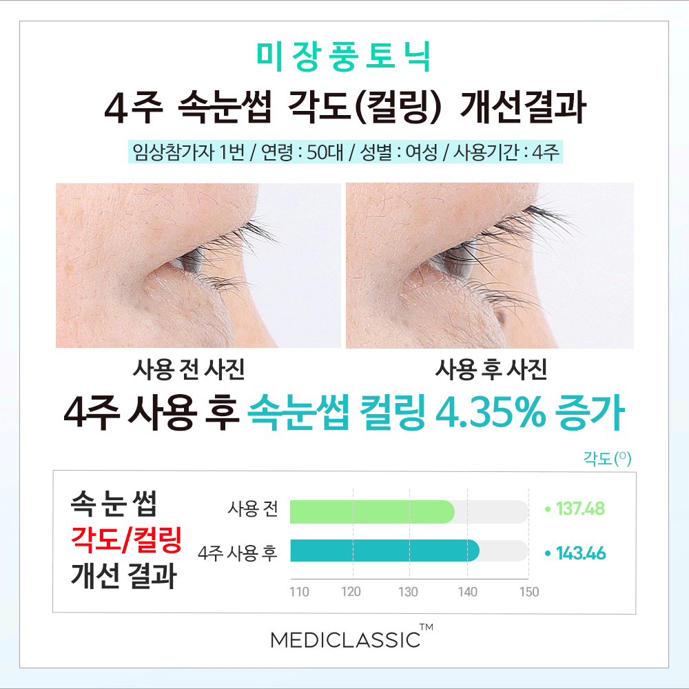 미장풍 골드 속눈썹 영양제 7ml