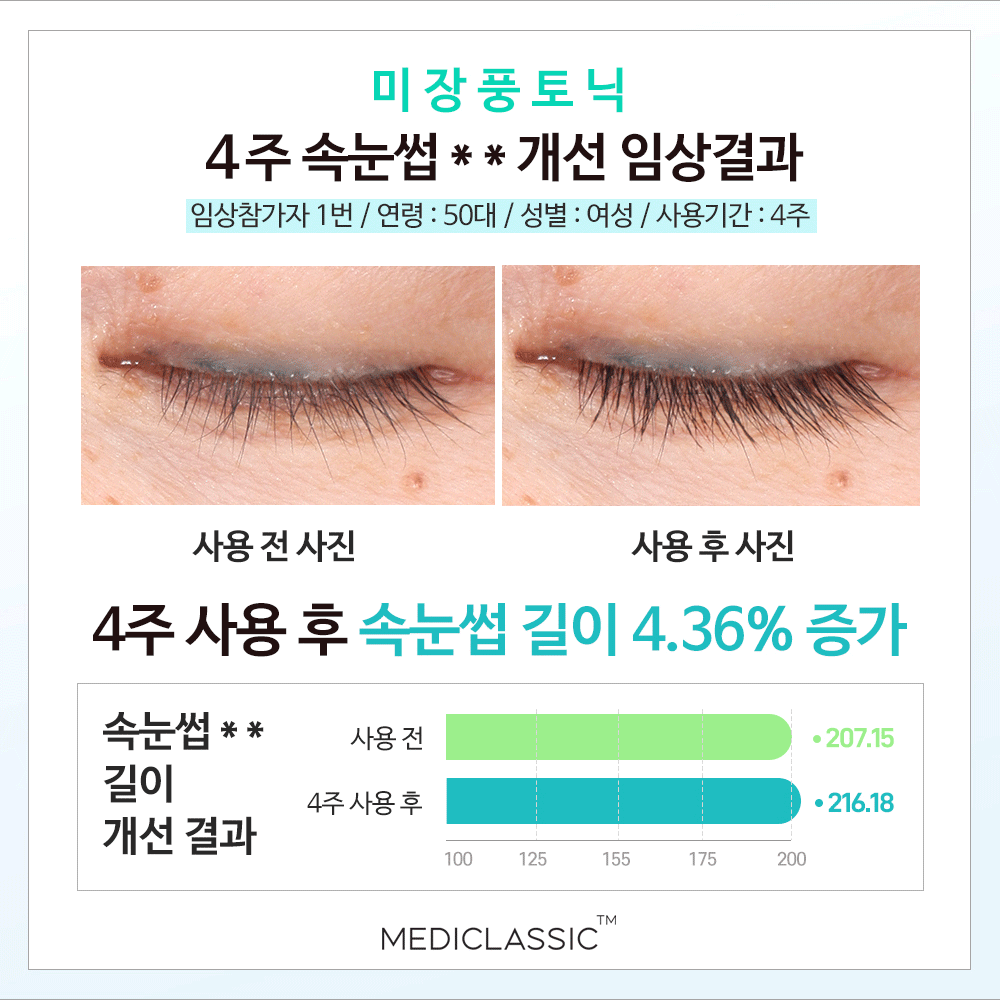 미장풍 골드 속눈썹 영양제 7ml