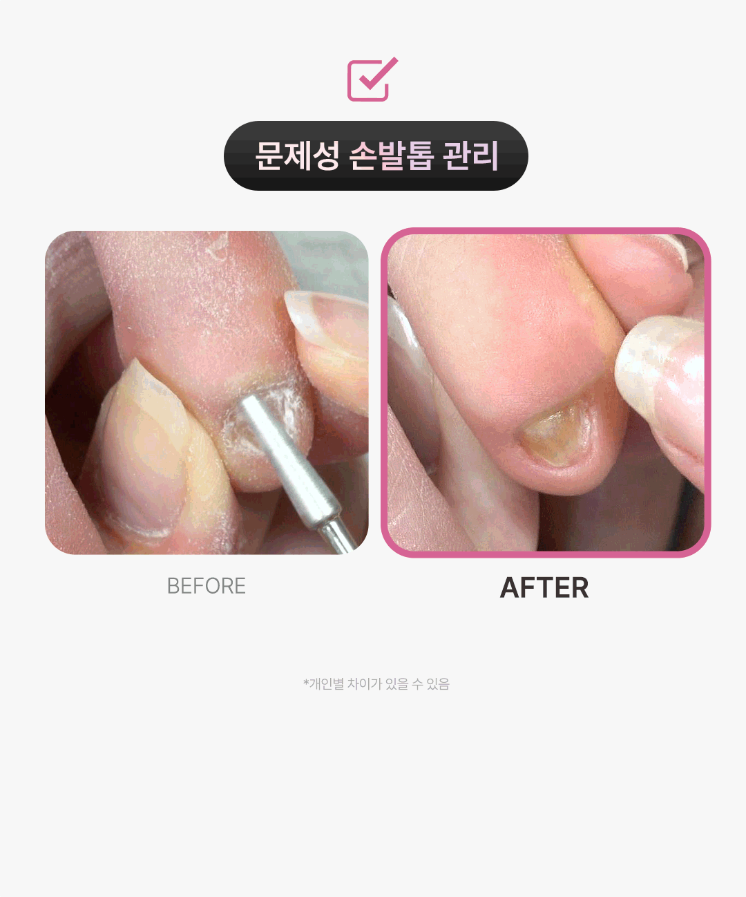 위드샨 에이스 네일 드릴