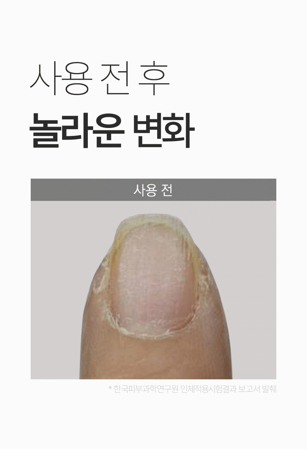위드샨 닥터비건 손톱 영양제