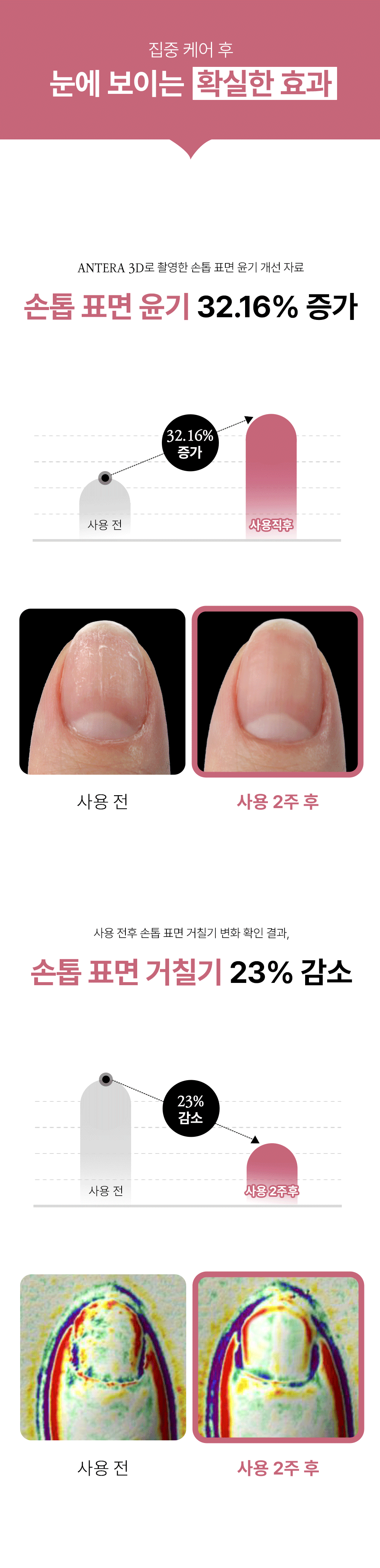 위드샨 네일 스트랭쓰너