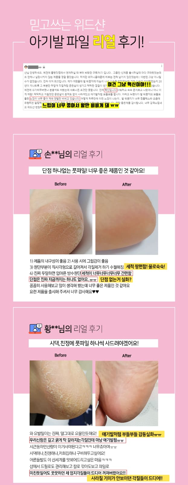 위드샨 아기발 파일 | 프로페셔널 풋파일