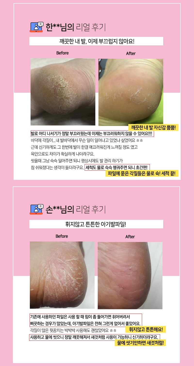 위드샨 아기발 파일 | 프로페셔널 풋파일