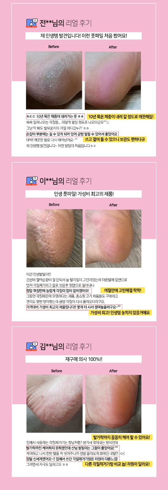 위드샨 아기발 파일 | 프로페셔널 풋파일