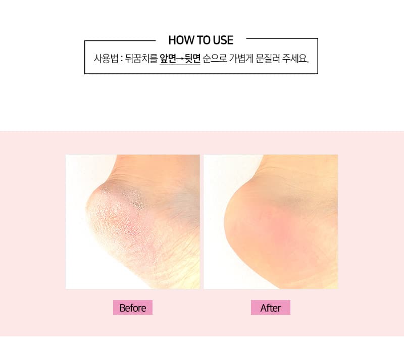 위드샨 아기발 파일 | 프로페셔널 풋파일