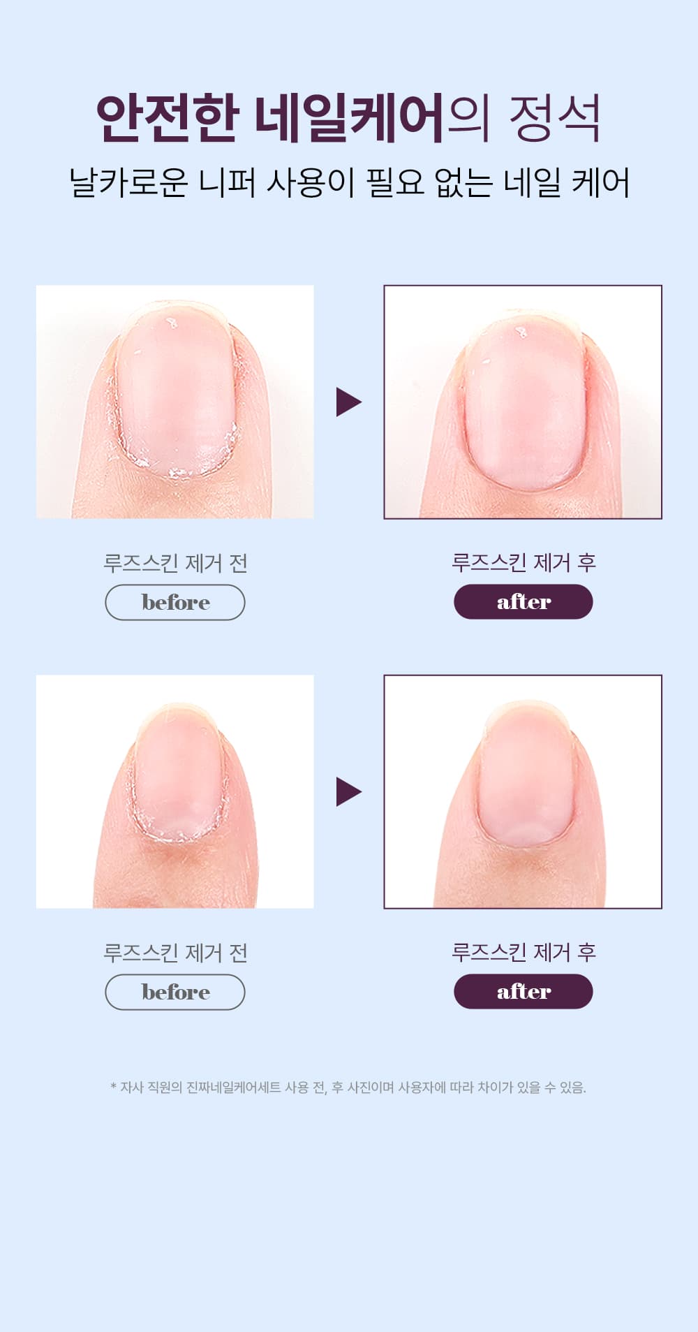 위드샨 루비푸셔