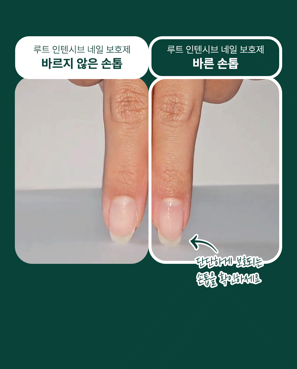 위드샨 루트 인텐시브 네일 보호제