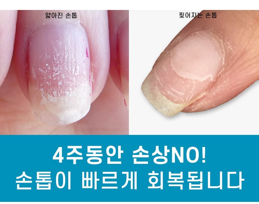뷰젤 네일 프로텍터 네일강화제 10ml