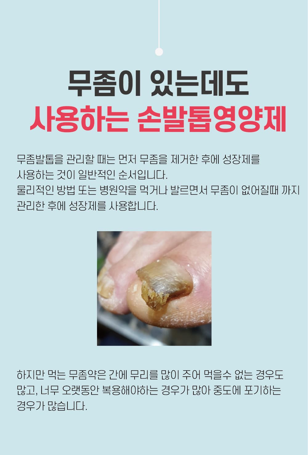 뷰젤 안티펑 5ml 손발톱 영양제 손톱강화제 네일 세럼