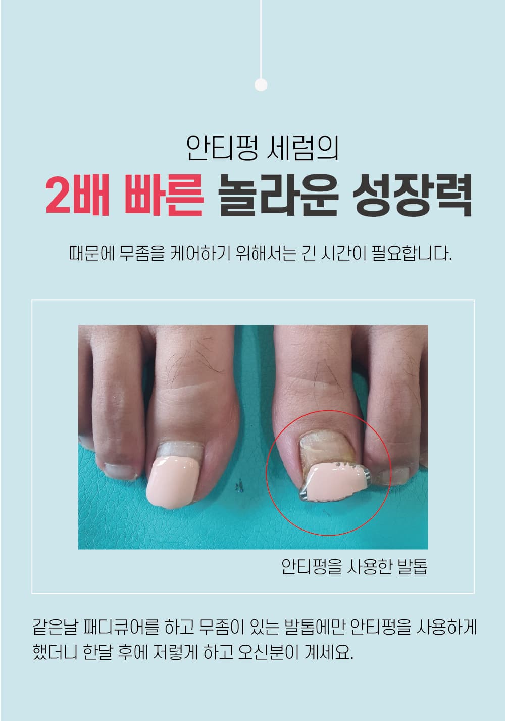 뷰젤 안티펑 5ml 손발톱 영양제 손톱강화제 네일 세럼