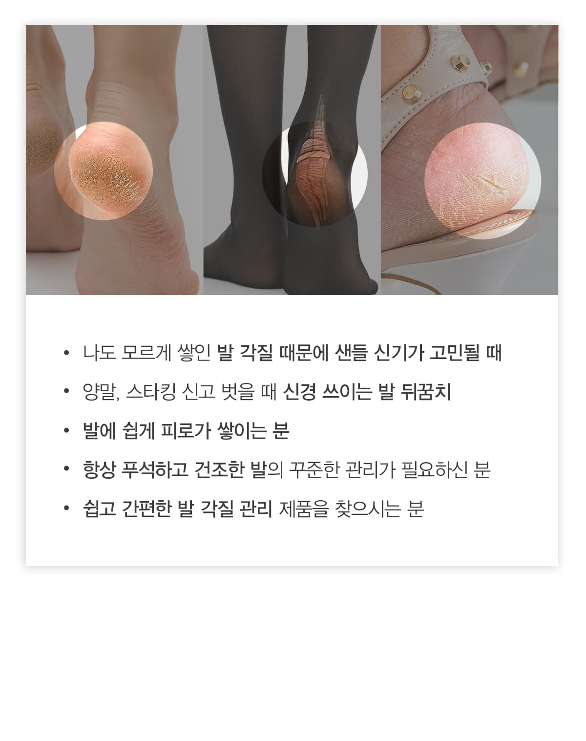 키스뉴욕 플로라 리프레싱 풋 크림 KFRFC01K 상세 이미지 6