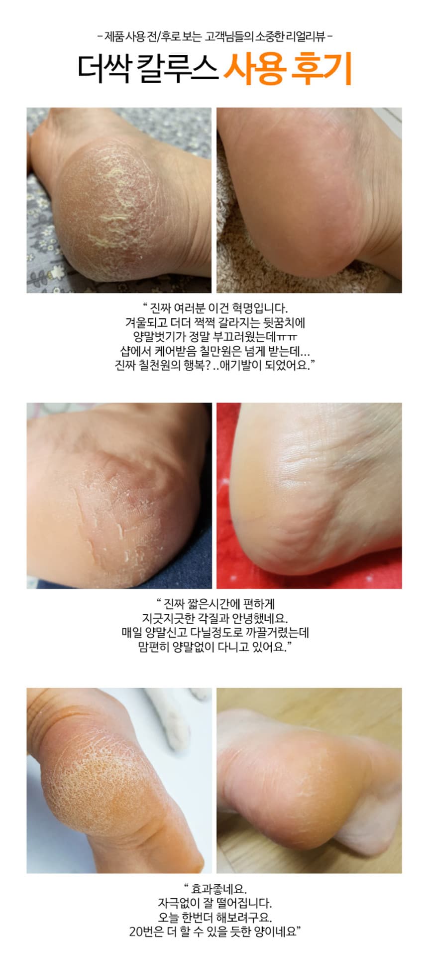 THE SSAK 더 싹 발 각질제거 리무버 연화제 200ml 1000ml 택 1 상세 이미지 2