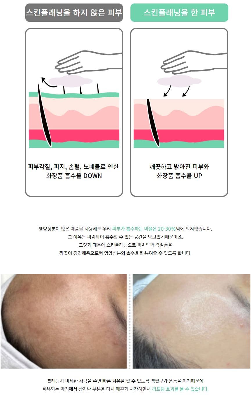 닥터더마 스킨 플래닝 7종 세트 상세 이미지 14