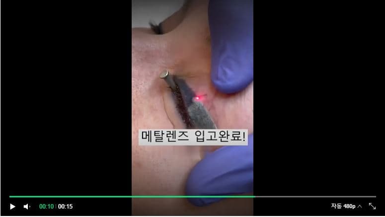 INi 이니 메탈 렌즈 상세 이미지 2