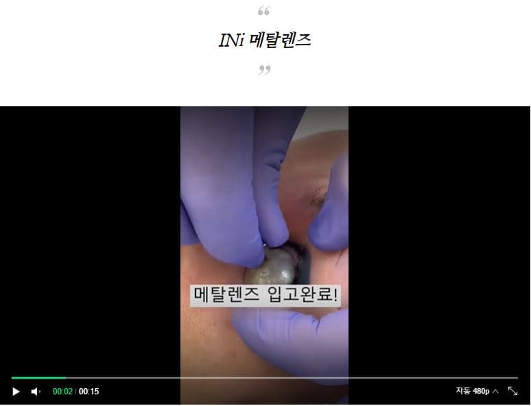 INi 이니 메탈 렌즈 상세 이미지 1