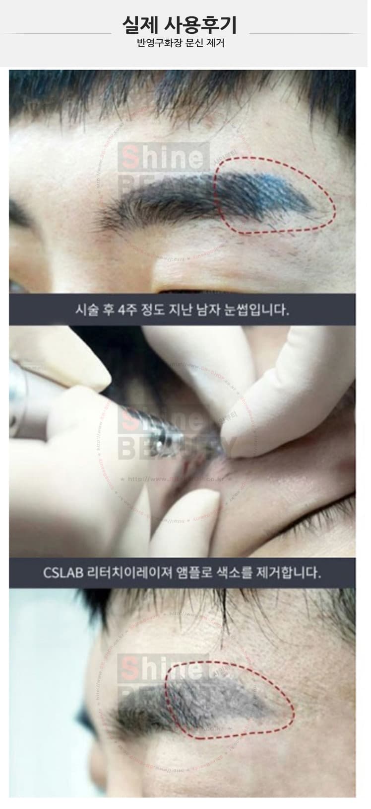 샤인뷰티 CS렙 이레이져 8ml 상세 이미지 3